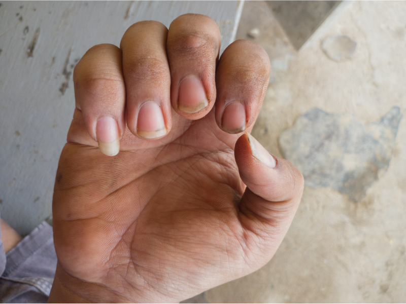 Why Dirty Nails Make You Look Unpolished