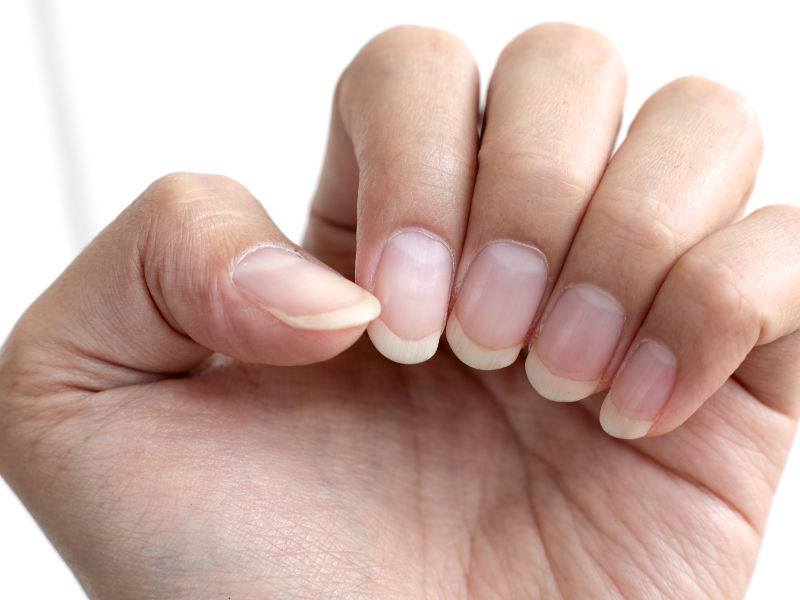 Why Do Fingernails Grow Faster Than Toenails? Nail Growth Differences Explained