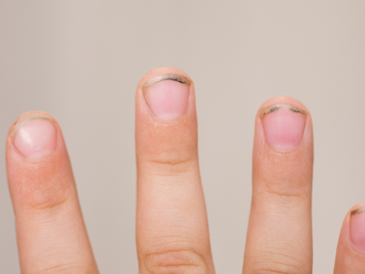 Why Does Dirt Collect Under Your Nails? Common Causes and How to Prevent It