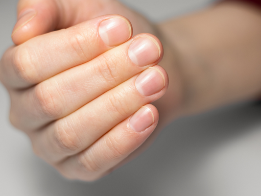 How to Prevent Dry Nails: Simple Daily Care Tips