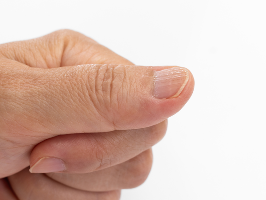 What Causes Vertical Ridges on Fingernails? Common Causes and Care Tips