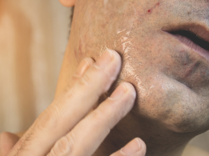 Why Do You Bleed When Shaving? What Causes It and How Can You Prevent It?