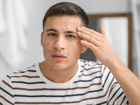 Is It Normal for Oily Skin to Feel Greasy After Shaving? Causes and the Right Care Routine