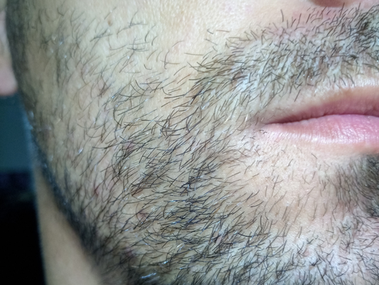 Why Does Beard Hair Grow in Different Directions?