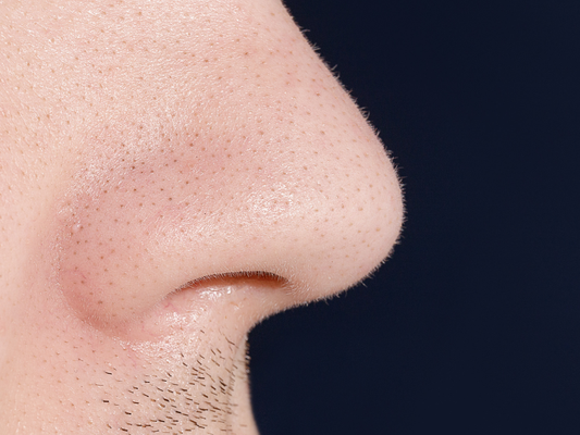 Why Does the Area Under My Nose Sting After Shaving?